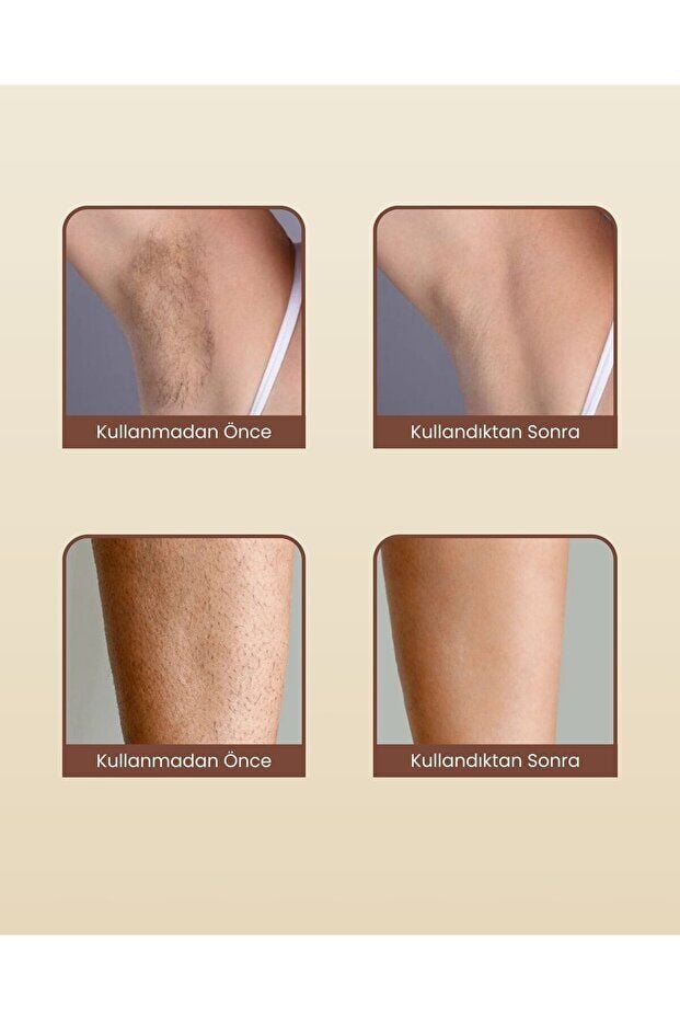 MİECO SAPPHİRE IPL 1 MİLYON ATIM LAZER EPİLASYON ALETİ